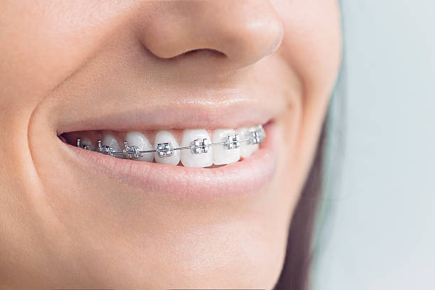 Best Tooth Extraction  in Kirby, TX